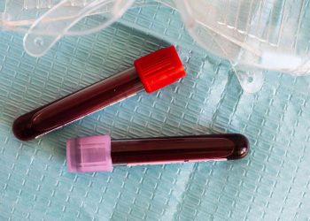 20 Songs about Blood